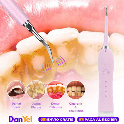 CEPILLO DE DIENTES ELÉCTRICO DE ALTA FRECUENCIA