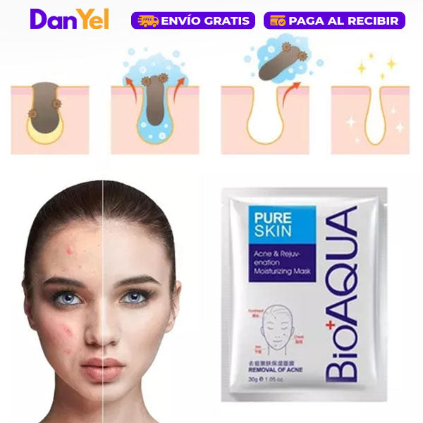 MASCARILLA ANTIACNÉ - BIOAQUA - COMPRA 1 Y LLEVA 2