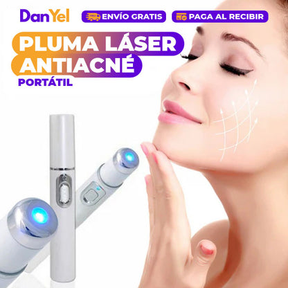 ✨ÚLTIMO DÍA 49% OFF🔥 PLUMA LÁSER ANTIACNÉ PORTÁTIL