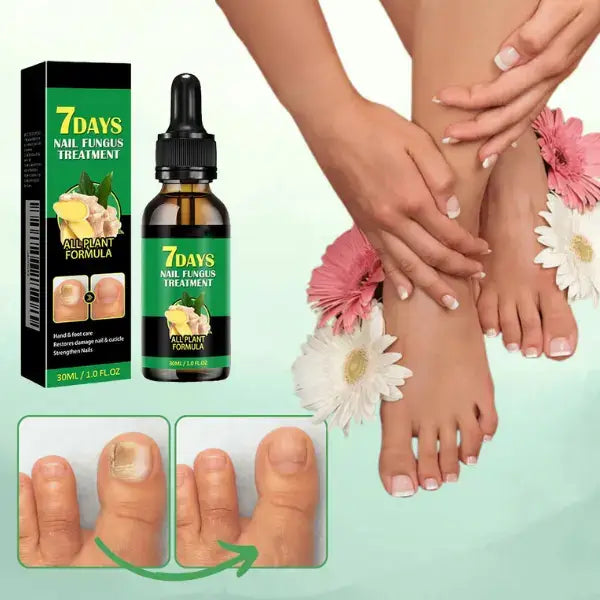 Aceite Milagroso para Uñas | Dile adiós a los hongos en 7 días L