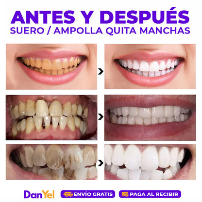 SUERO BLANQUEADOR DENTAL 2 EN 1: BLANQUEA Y REPARA