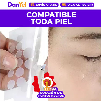 KIT DE CUIDADO FACIAL: PARCHES ANTIACNÉ+ 🎁 SUCCIÓN PROFESIONAL DE PUNTOS NEGROS GRATIS