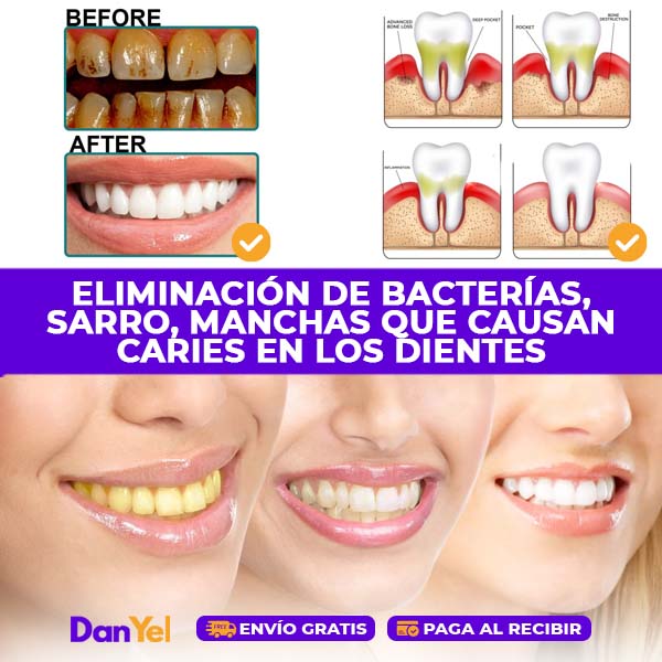 SUERO BLANQUEADOR DENTAL 2 EN 1: BLANQUEA Y REPARA