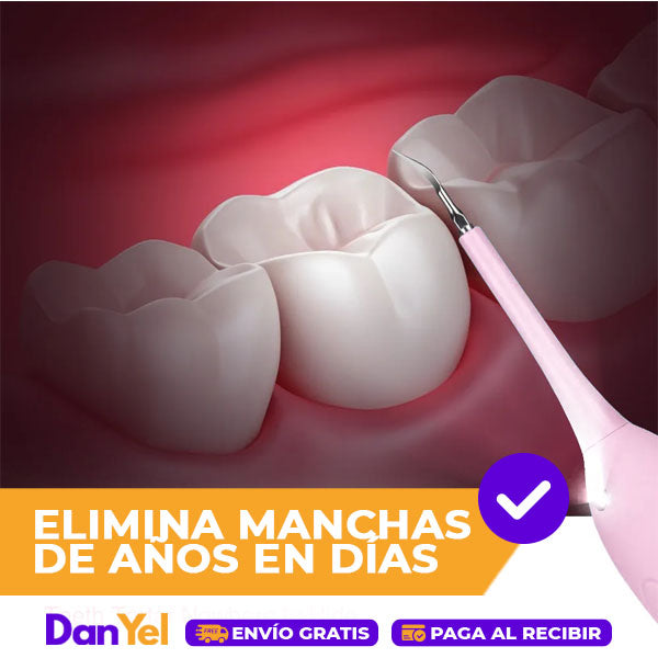 CEPILLO DE DIENTES ELÉCTRICO DE ALTA FRECUENCIA