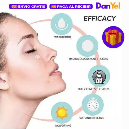 KIT DE CUIDADO FACIAL: PARCHES ANTIACNÉ+ 🎁 SUCCIÓN PROFESIONAL DE PUNTOS NEGROS GRATIS