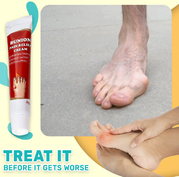 Crema para Pies | Alive Bunion