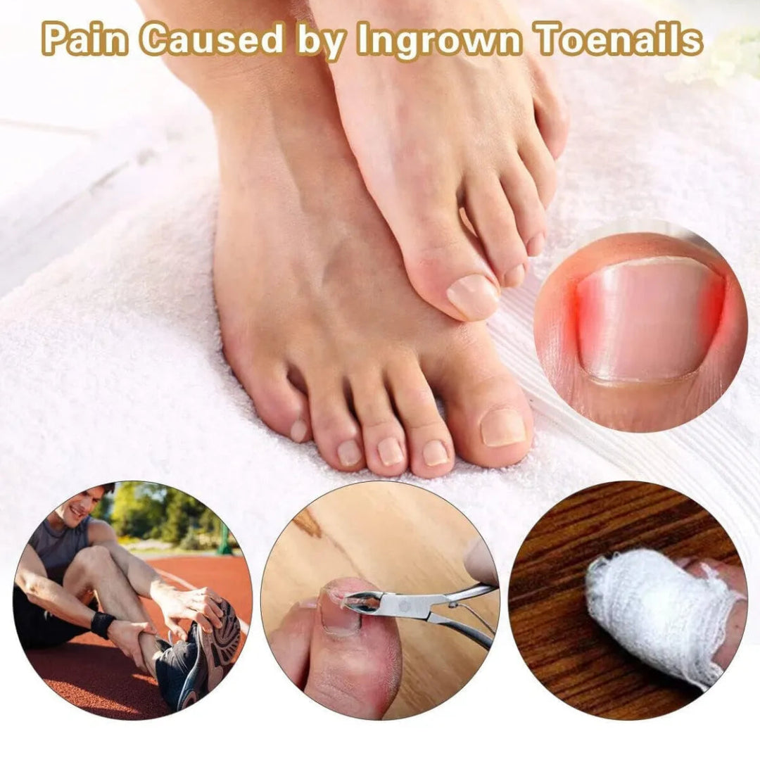 Parche Corrector de Uñas